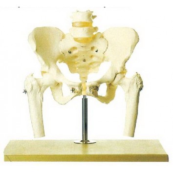 LIFE-SIZE PELVIS WITH 5PCS LUMBER VERTEBRAE MOL225